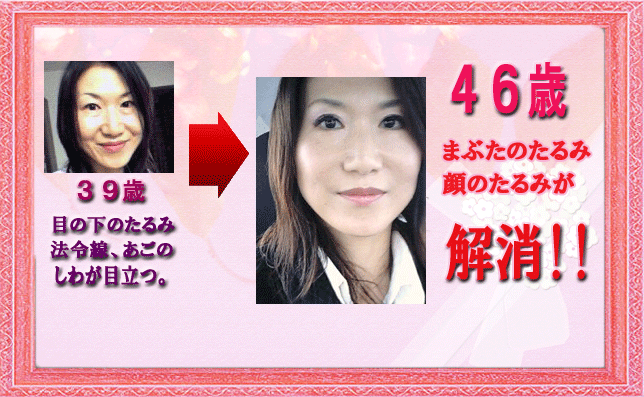 どちらの写真が若く見えますか?